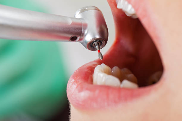 Best Emergency Treatment for Toothache in Western Springs, IL